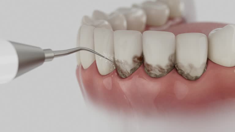 Reliable Teeth Cleaning And Checkup contractor in Wayne County County, MS by Dentist Open Now